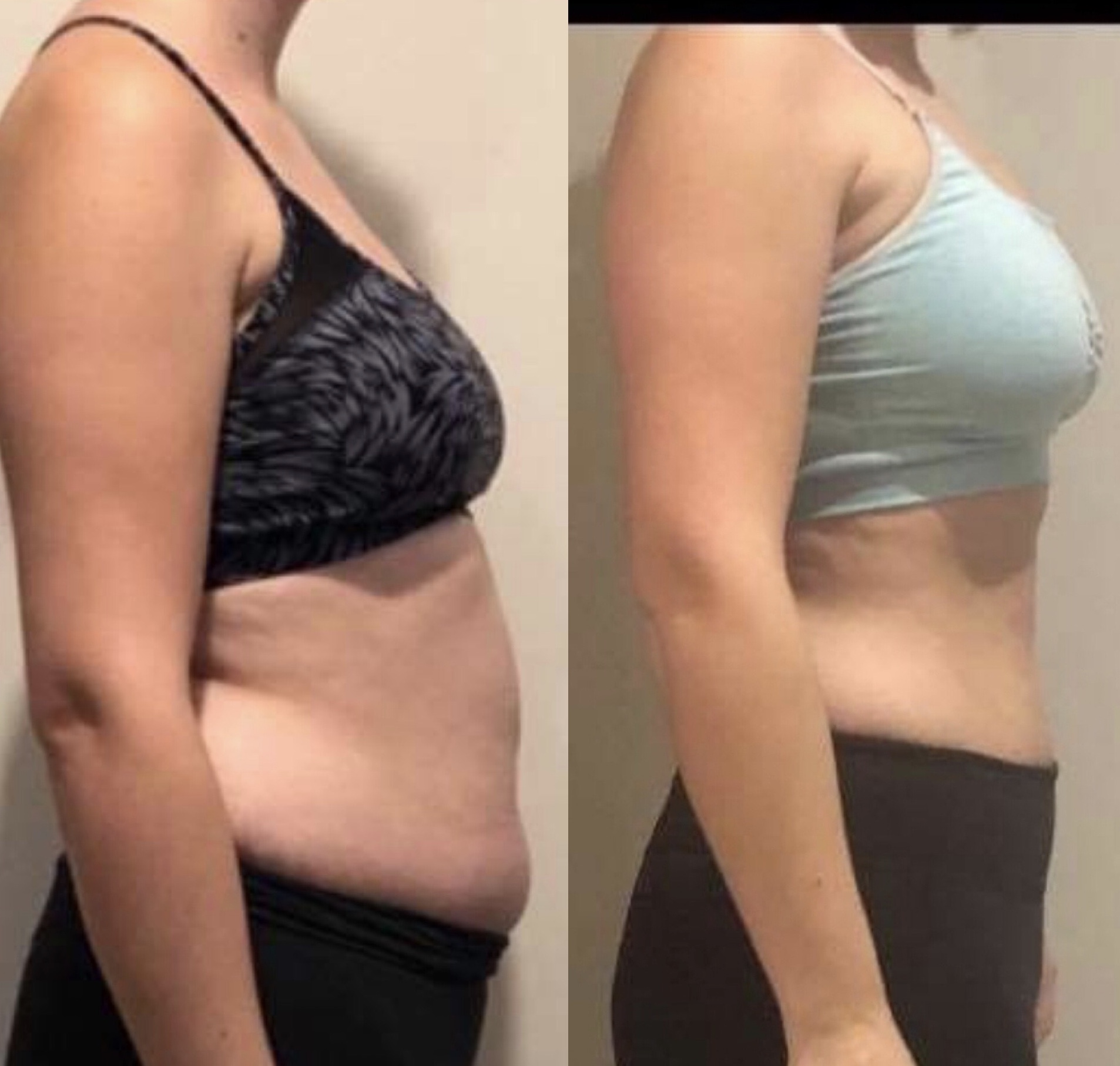 Member transformation result
