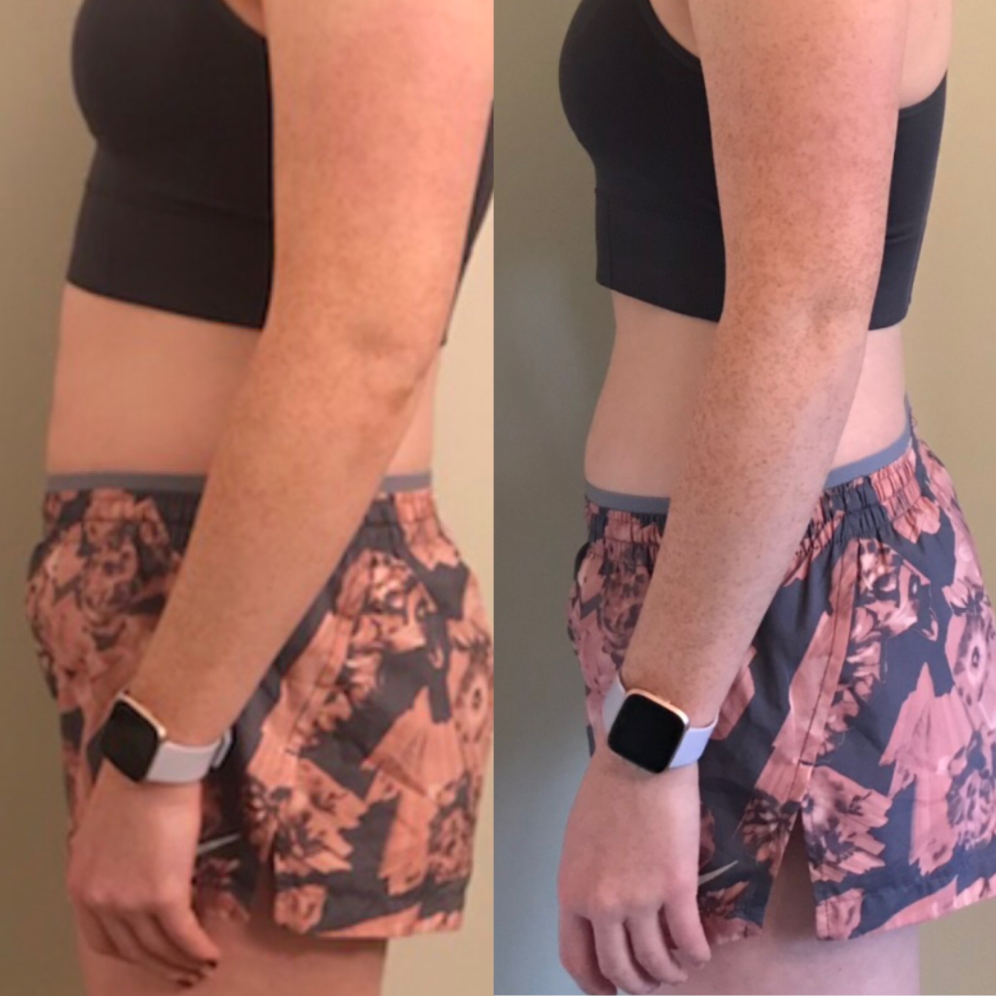 Member transformation result